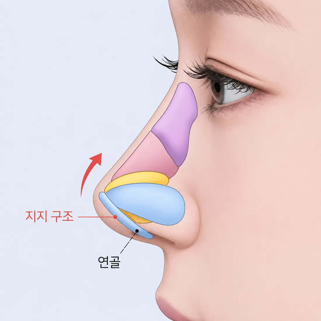 비개방 코성형 케이스1