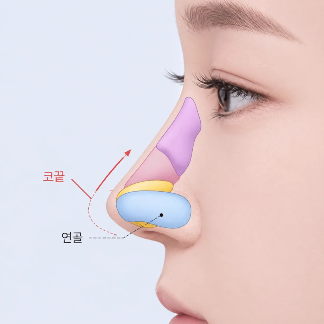 비개방 코성형 케이스2
