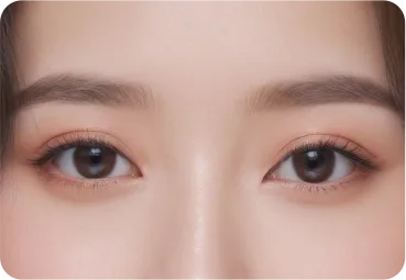 눈재수술 1