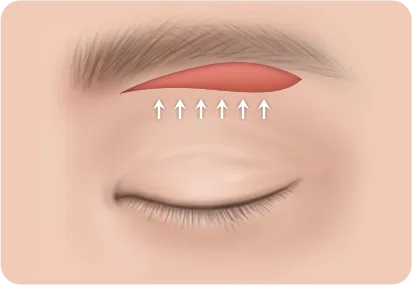 눈썹하거상 3