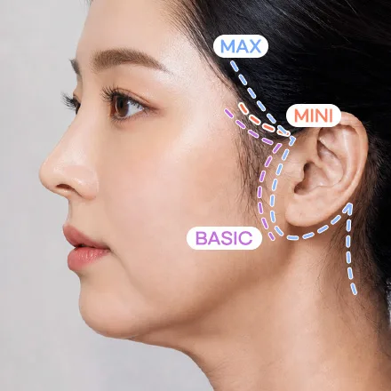 안면거상 과정