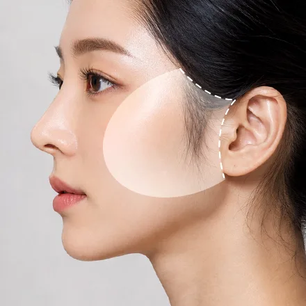 안면거상 과정
