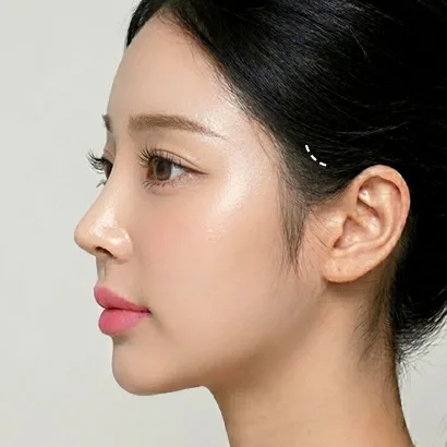 미니거상 과정