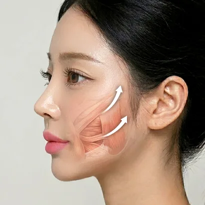미니거상 과정
