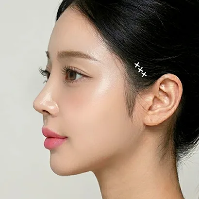 미니거상 과정