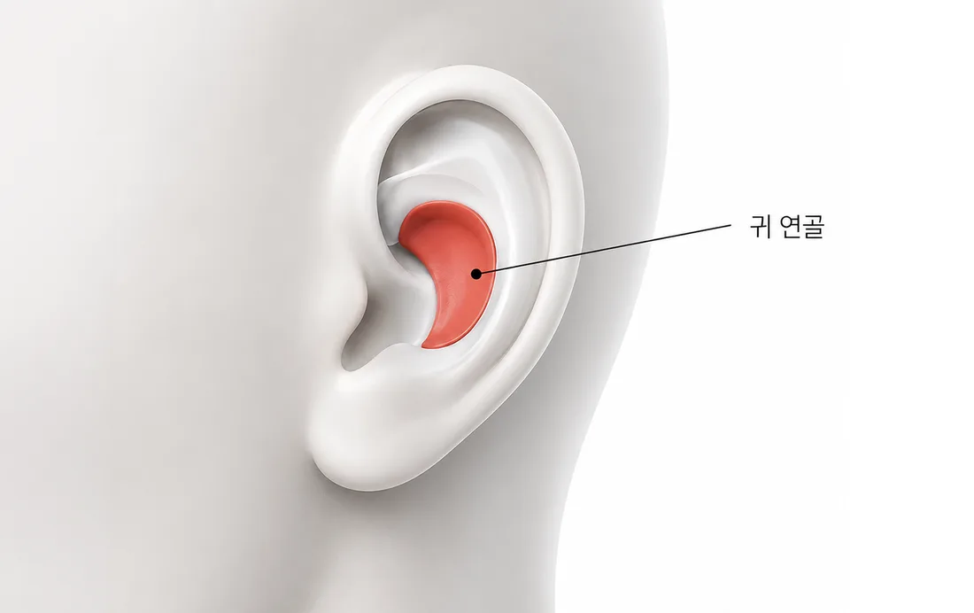 코재수술 2