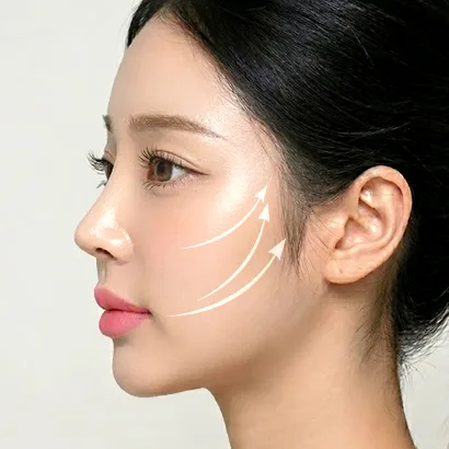 실리프팅 과정