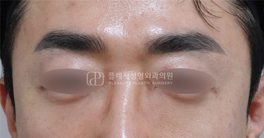Case 01 After