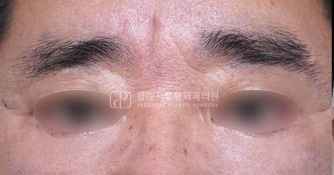 Case 04 After
