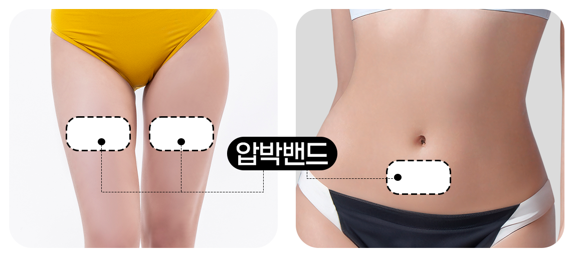 지방이식_압박밴드 예시이미지