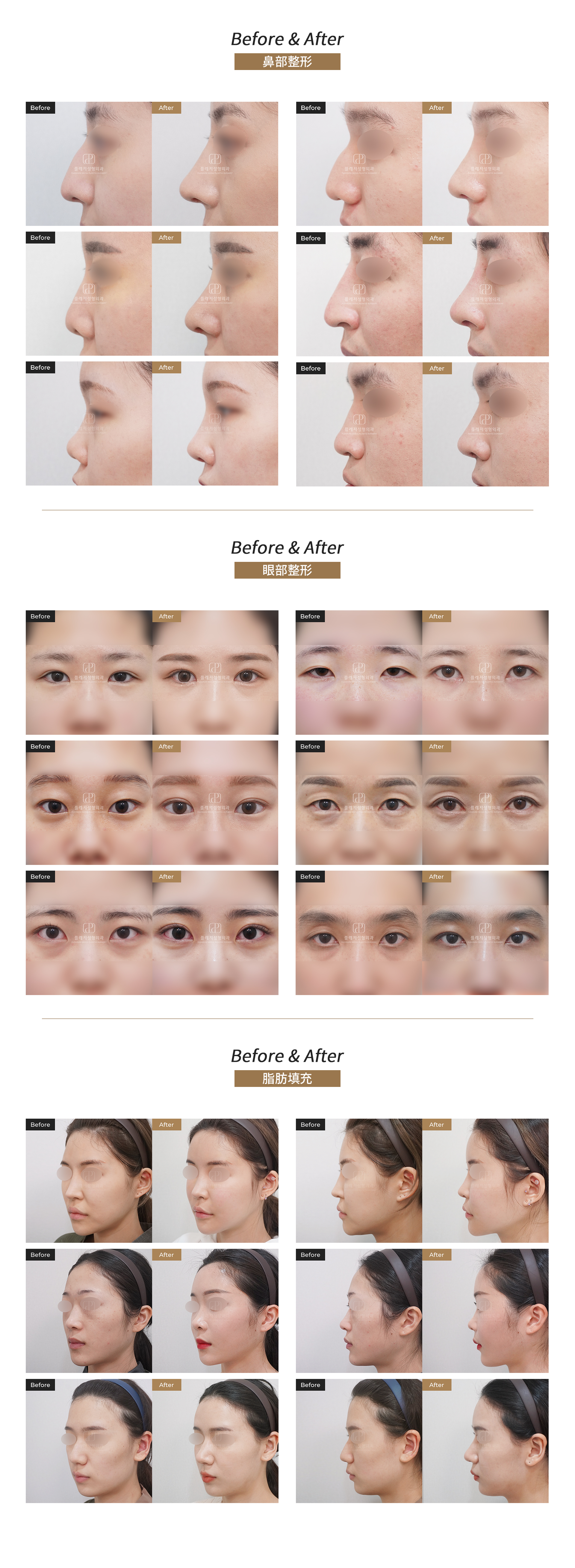 before&after